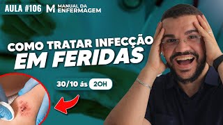 COMO CICATRIZAR FERIDAS INFECTADAS 2X RAPIDO EM 4 PASSOS [upl. by Aniale869]