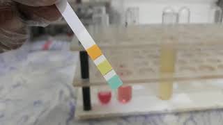 Urine Albumin Test [upl. by Anileme434]