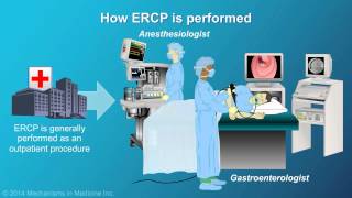 Understanding ERCP Endoscopic Retrograde Cholangiopancreatography [upl. by Semele]