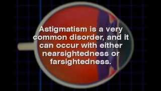 What is Astigmatism How does it cause eye strain [upl. by Ettevets432]