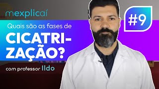 mexplicaí 09 Quais são as fases de cicatrização  RentalMed [upl. by Enylecoj]