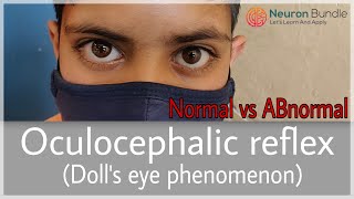 Doll’sEyeReflex Vestibulo Ocular reflex Normal amp ABnormal MADEEASY medicine neurology [upl. by Costin]