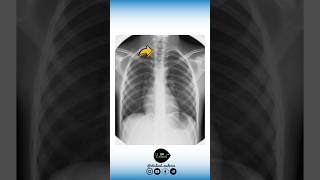 🔻 Anatomie VS Radiologie [upl. by Townshend]