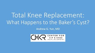 Total Knee Replacement  What Happens to the Bakers Cyst [upl. by Antoine300]