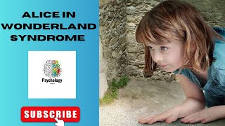 Alice in Wonderland Syndrome Visual Disturbance PsychologyToday 2023 [upl. by Ttelrats]