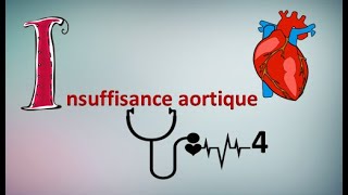 Comprendre linsuffisance aortique en 5 min ⏲️✔️ [upl. by Anasor]