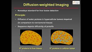 Liver metastases  what the radiologist needs to know W Schima [upl. by Namor862]