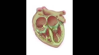 Ablation of AV node reentrant tachycardia AVNRT [upl. by Mafalda]