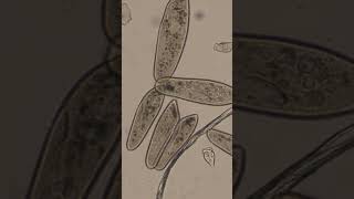 Paramecium Conjugation [upl. by Wehttam]