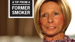 CDC Tips From Former Smokers  Terrie H Little Things I Miss [upl. by Hathcock]