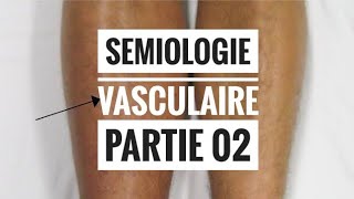 Sémiologie Vasculaire  partie 02 Examen Veineux [upl. by Anetta326]