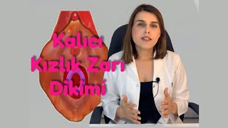 Kalıcı Kızlık Zarı Dikimi Sonrası Kanama Olur Mu  Op Dr Funda Yazıcı Erol [upl. by Roskes544]