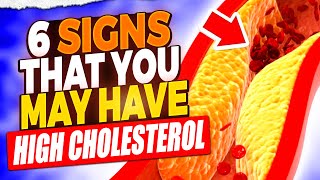 High Cholesterol Alert 6 Symptoms You Shouldnt Ignore [upl. by Allan]