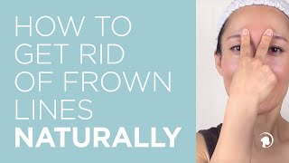 How to Get Rid of Frown Lines Naturally [upl. by Buchalter457]