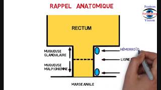 Hémorroïdes externes internes traitement du saignement pendant la grossesse [upl. by Agathe]