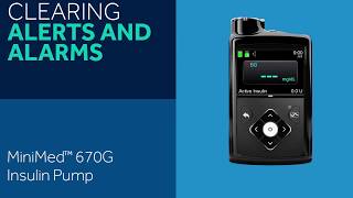 How to Clear Alerts and Alarms on the MiniMed 670G Insulin Pump [upl. by Atir144]