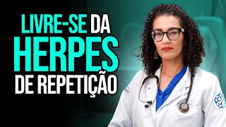 Herpes  Como Prevenir Herpes Simples de Repetição [upl. by Ruyle]