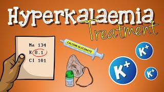 Hyperkalemia Treatment [upl. by Askari504]