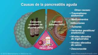 Pancreatitis aguda [upl. by Enomal]