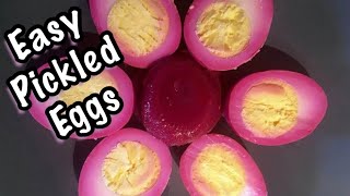 Easiest PICKLED EGGS My favorite yet simple recipe [upl. by Durrett]