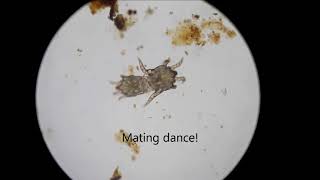 Nasty Cat Mites UNDER THE MICROSCOPE [upl. by Biernat]