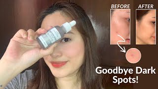 Goodbye Dark Spots Luxe Organix Whitening Repair Serum Niacinamide 10 Honest Review [upl. by Niamjneb]