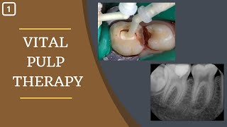 What is Vital Pulp Therapy and Material Used in VPT [upl. by Anirroc]