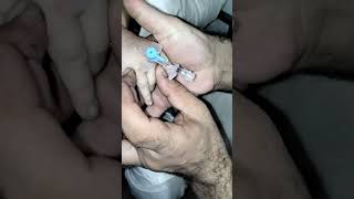 I v cannula procedure youtuberyoutubeshortscannulationyoutubembbsytcannulation [upl. by Anastasio]