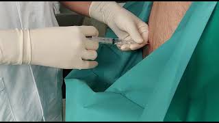 Procedure CFM  Spinal anaesthesia Anestesia spinale [upl. by Ennalorac507]