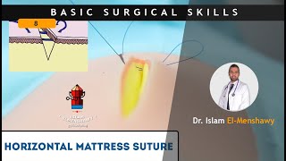 Horizontal Mattress Suture [upl. by Nairoc382]