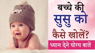 Baby Boy ka susu kaise khole  Kaise Open Kare  How to open private part of Baby Boy [upl. by Eilujna552]