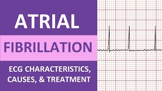 Atrial Fibrillation AFib ECG Treatment Causes Nursing NCLEX Review ACLS [upl. by Alael]