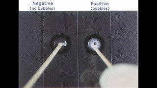 Catalase Test  How to perform [upl. by Shimkus]