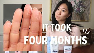 What Causes Dry Skin On Your Feet [upl. by Laeno717]