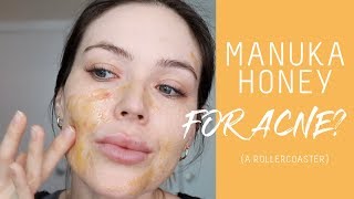 I tried manuka honey for acne  hyperpigmentation  Nicole Masifilo [upl. by Gorges]