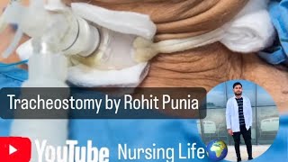 Tracheostomy by Rohit Punia [upl. by Leahcimaj]