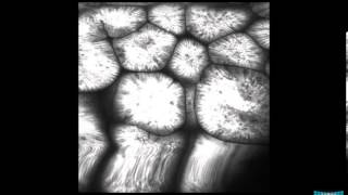 Confocal Endomicroscopy of the Stomach Gastritis Int Metaplasia Adenoma and Gastric Cancer [upl. by Guidotti]