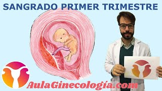 SANGRADO PRIMER TRIMESTRE Diagnóstico diferencial causas ecografía  Ginecología y Obstetricia [upl. by Zullo32]