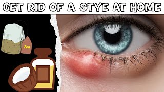 How To Get Rid Of A Stye At Home Natural Remedies For Stye Best Ways To Get Rid Of A Stye Easily [upl. by Enelra488]