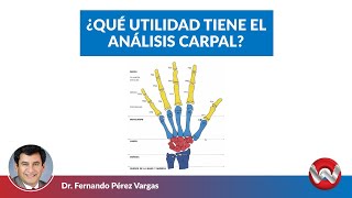 ¿Que utilidad tiene el análisis carpal [upl. by Yleme854]