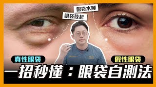 眼袋自測法！一秒搞懂「真性眼袋」vs「假性眼袋」｜周杰醫師 [upl. by Michale]