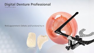 Digital Denture – third Appointment [upl. by Gordan]