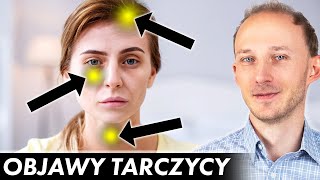 17 oznak że Twoja tarczyca woła o pomoc Niedoczynność tarczycy objawy  Dr Bartek Kulczyński [upl. by Pass]