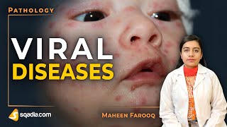 Viral Diseases  Smallpox  Pathology Video  Medical Education Channel  VLearning [upl. by Daryl]