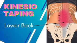 Lumbar spine or Sacroiliac Joint pain  try Kinesiology Taping technique using Rocktape Big Daddy [upl. by Nikolos]