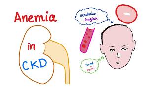 Anemia in Chronic Kidney Disease [upl. by Eneluj]