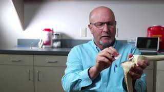 Partial Knee Replacement Explained by Dr Martin Redish [upl. by Niessuh]