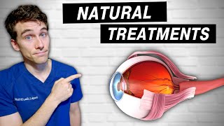 7 Natural Ways to Prevent amp Treat Glaucoma  QampA [upl. by Fretwell485]