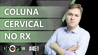 COLUNA CERVICAL NO RX  UMA BREVE REVISÃO [upl. by Nicolis]