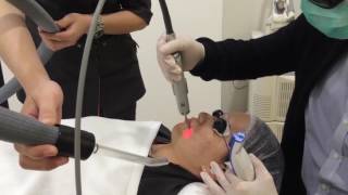 Fotona 4D Laser Skin Tightening  NonSurgical Facelift amp Skin Tightening [upl. by Einnek]